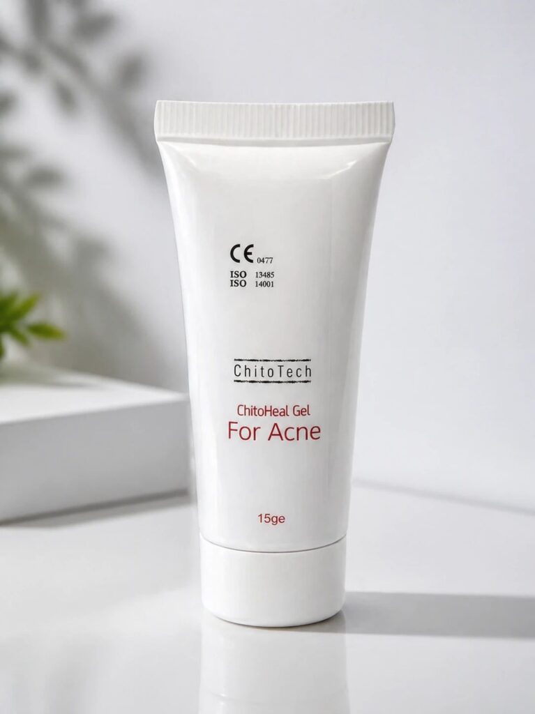 Acne