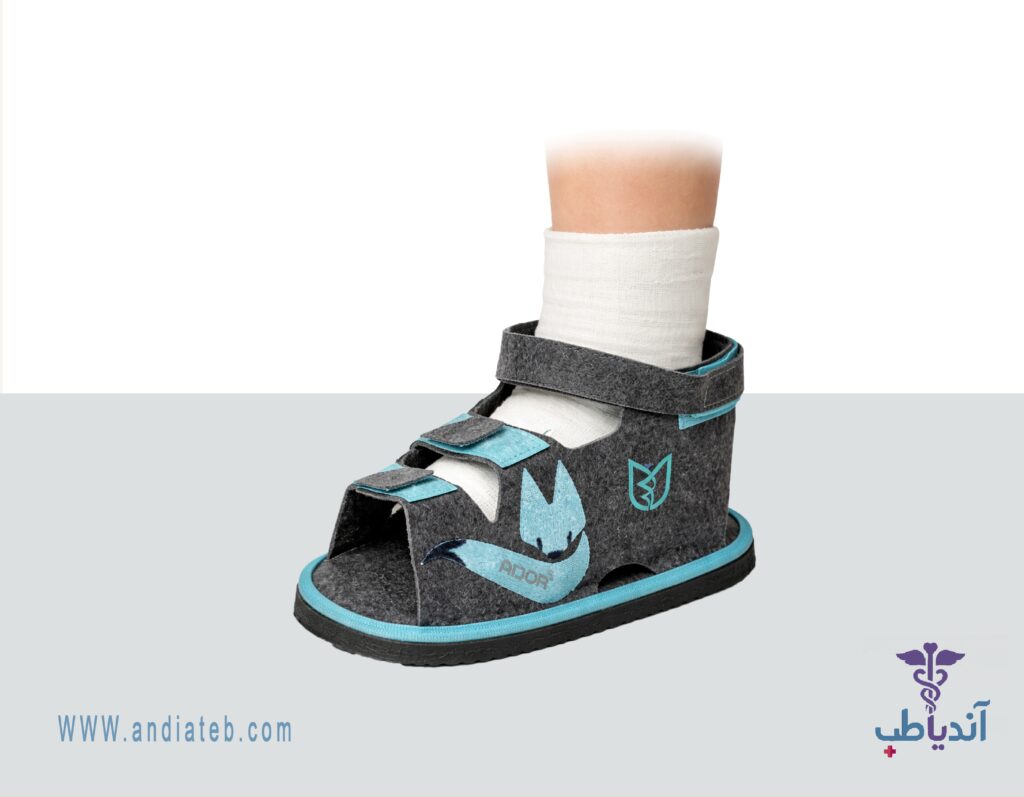 کفش_زیر_گچ_کودکان_آدور_